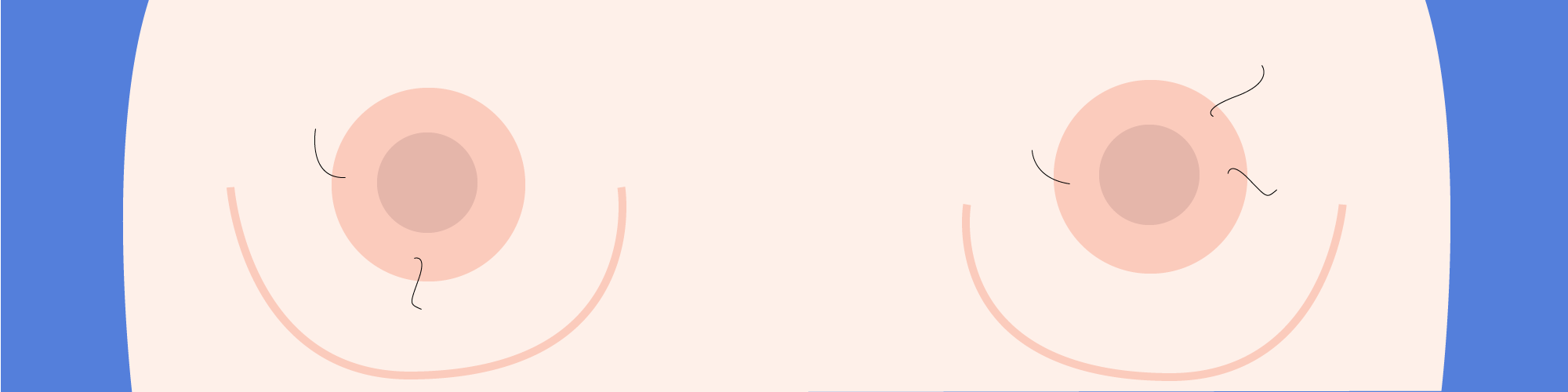 Types of nipples: These are all the different types of nipples