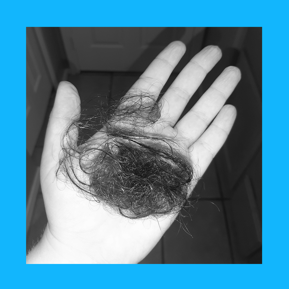 mya geans hair loss