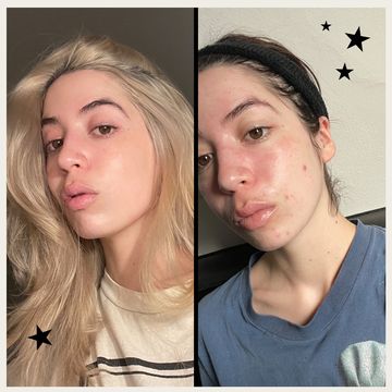tatjana before and after photos