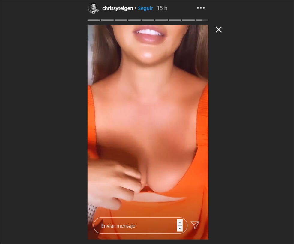 chrissy teigen
