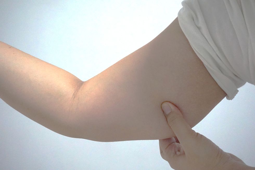 單單胖在手臂部位有可能是長期心血管循環不良