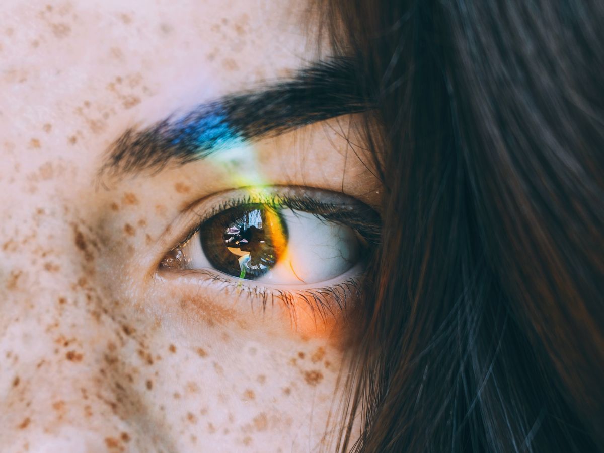 Doctor, doctor: What's causing the yellow streaks in my eyes?, Health &  wellbeing
