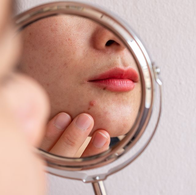 cropped shot of woman worry about her face when she saw the problem of acne occur on her chin by a mini mirror