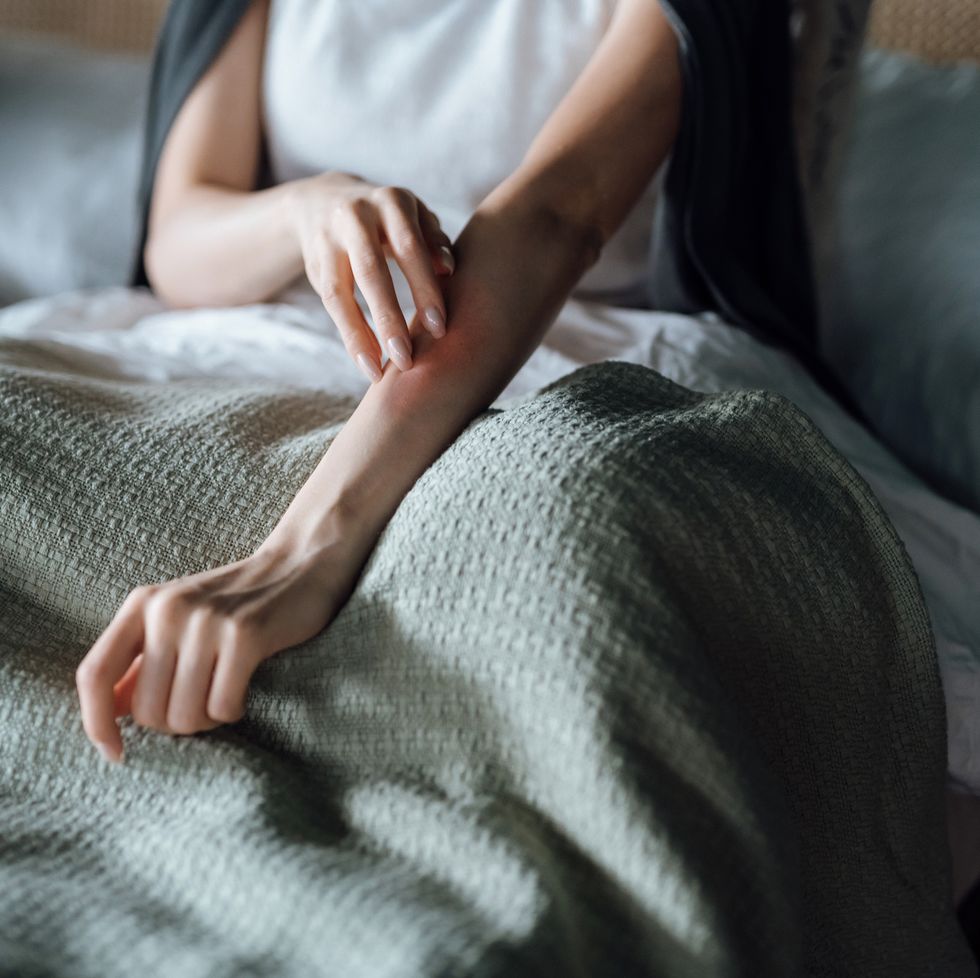 cropped shot of young woman suffering from skin allergy, scratching her forearm with fingers