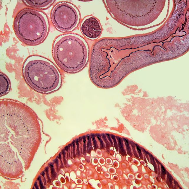 Cross section of a portion of an Ascaris female parasitic roundworm. (Magnification x100)