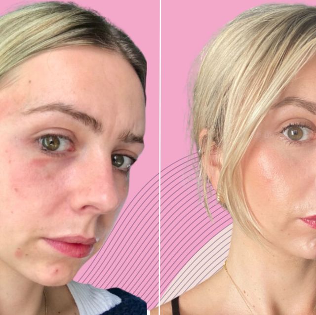 Why you should ditch your excessive skincare habits