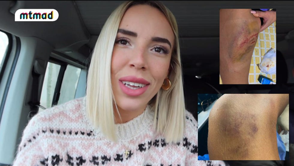 danna ponce cuenta con detalles cómo fue su accidente de moto con su novio