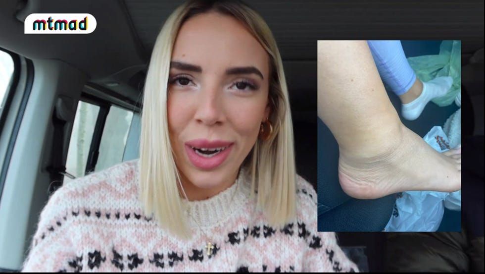 danna ponce cuenta con detalles cómo fue su accidente de moto con su novio