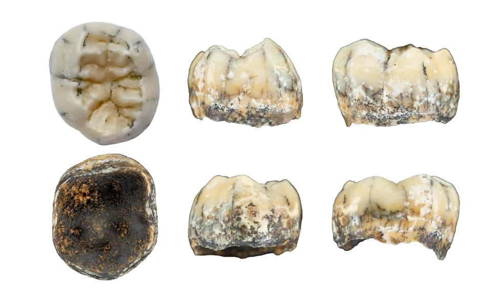 De algemene vorm en de inwendige structuren van de grote kies lijken op eerder gedentificeerde tanden van een Denisovamens in een kaak die aan de rand van het Tibetaans Hoogland is gevonden Fossielen van deze raadselachtige groep zijn zeldzaam Dat maakt het een uitdaging om nieuw gevonden botten of tanden als Denisovaans te identificeren