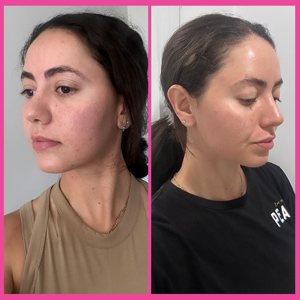 diamondglow facial before and after