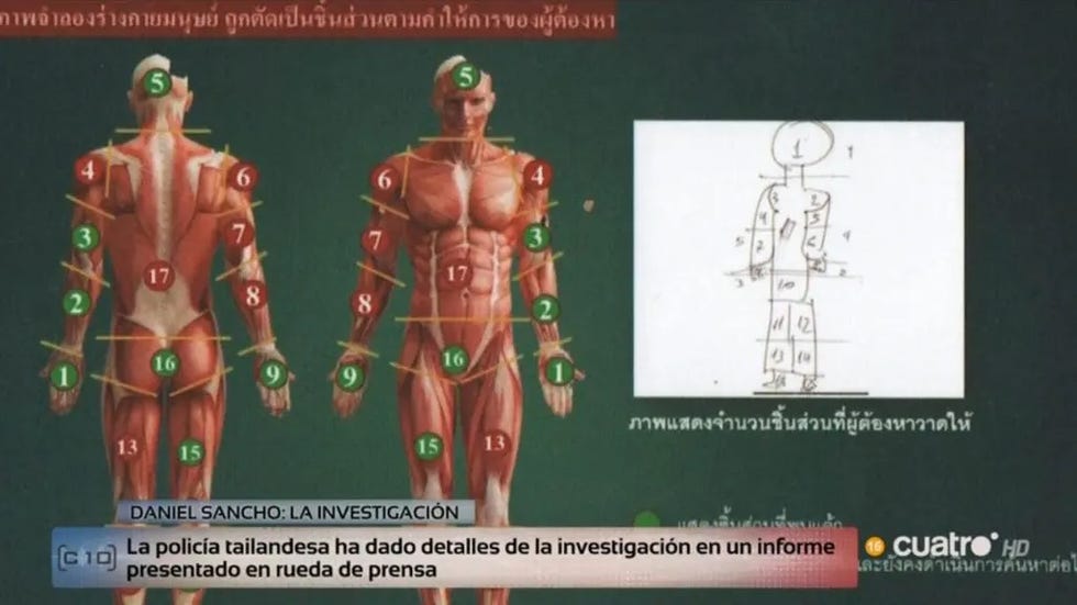 boceta daniel sancho