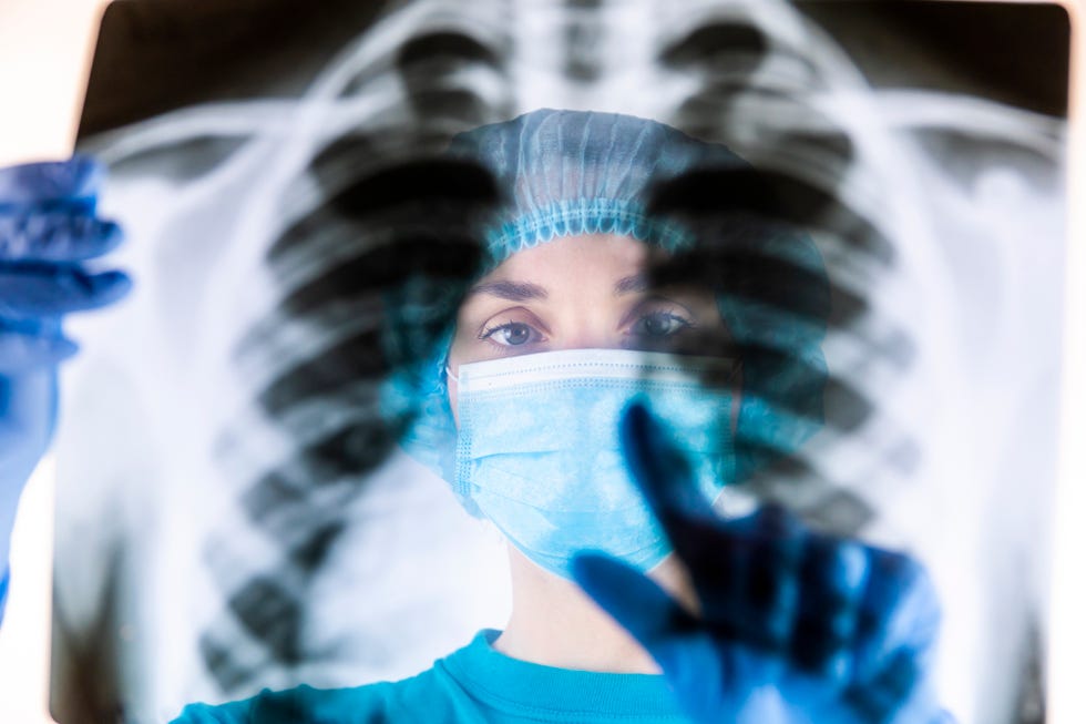 una doctora estudia una radiografía
