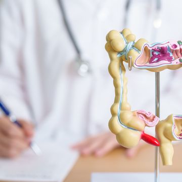 doctor with human colon anatomy model colonic disease, large intestine, colorectal cancer, ulcerative colitis, diverticulitis, irritable bowel syndrome, digestive system and health concept