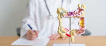 doctor with human colon anatomy model colonic disease, large intestine, colorectal cancer, ulcerative colitis, diverticulitis, irritable bowel syndrome, digestive system and health concept