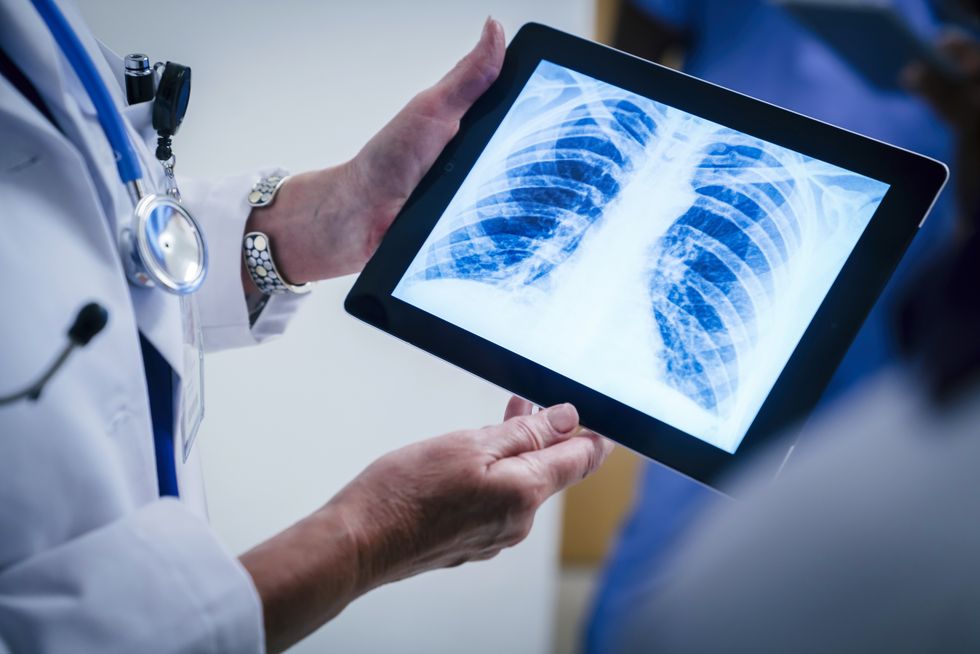 Doctors examining x-ray of chest and ribs on digital tablet
