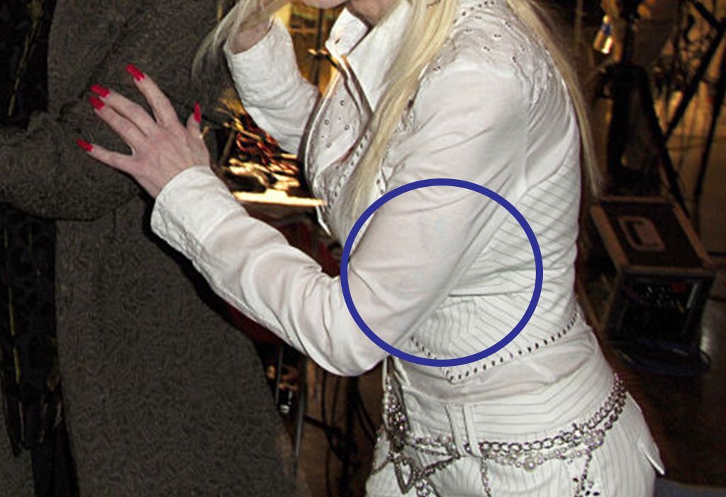 Dolly Parton Says She Got Her Tattoos To Cover Up Sca vrogue.co