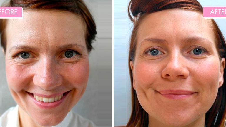 what drinking 3 litres of water a day does to your skin