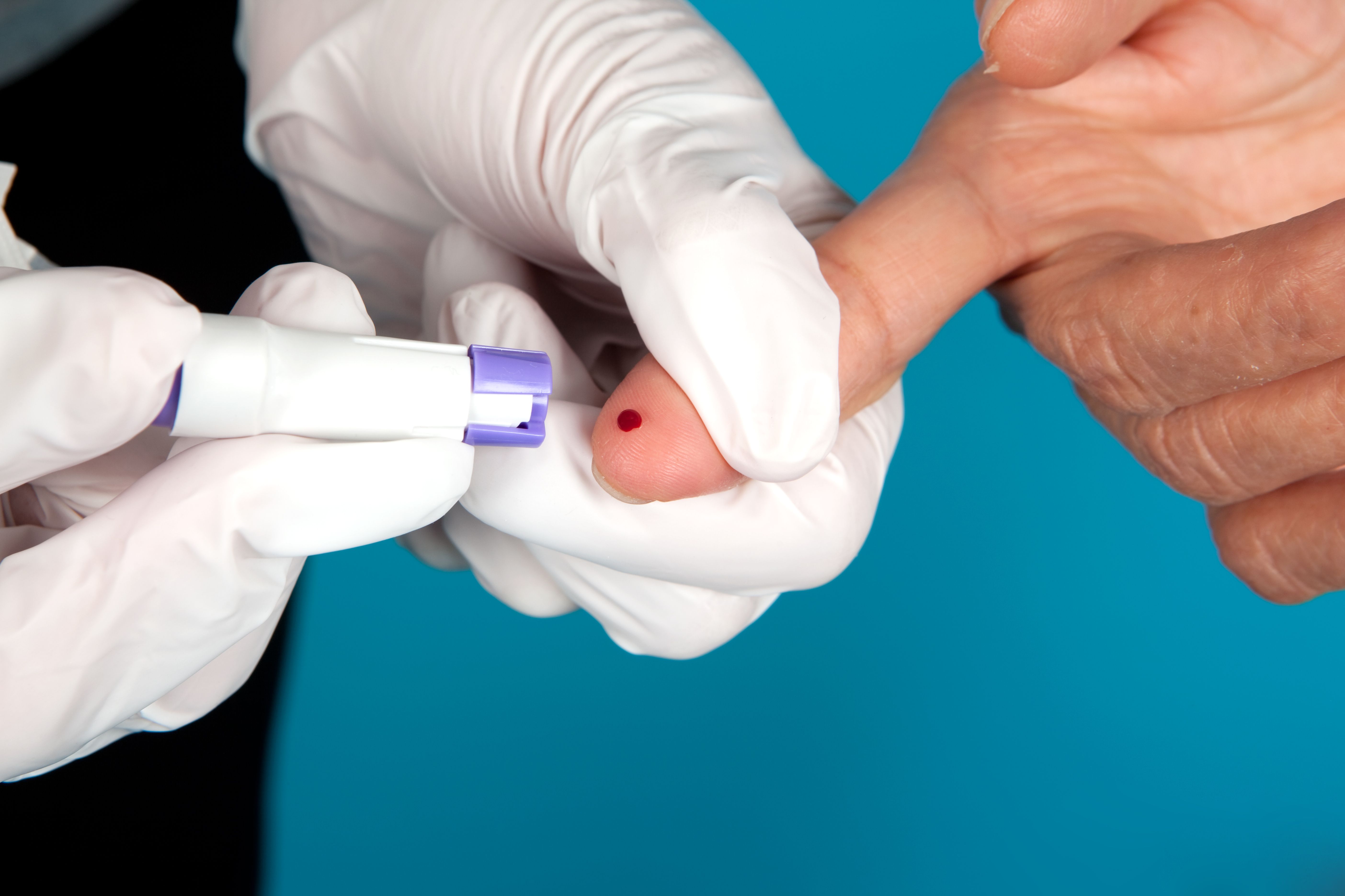 Кровь из пальца результаты. Тест на ВИЧ.