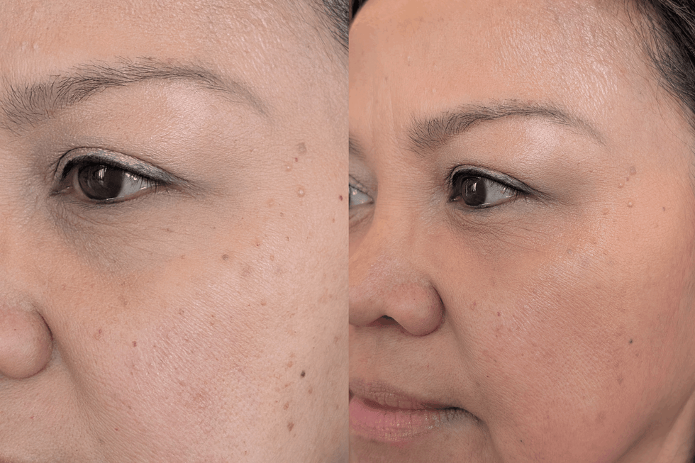 best color correctors — Elf camo concealer elf camo concealer
