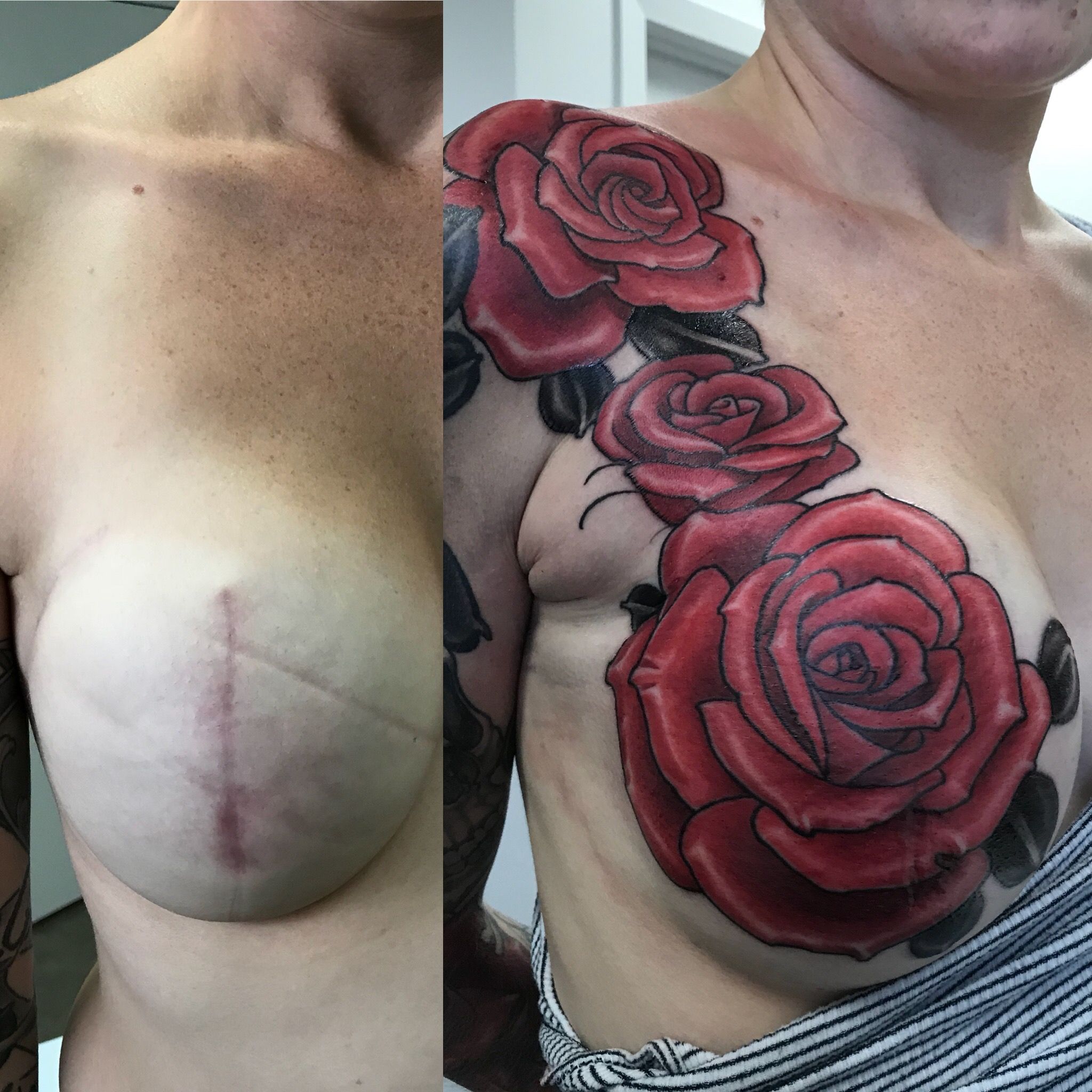 Mastectomy Tattoos: Information, Health Risks, Ideas and More