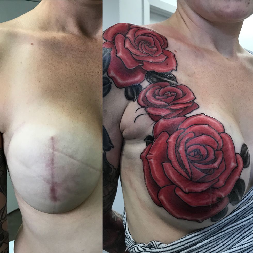 Why I got a tattoo to cover my mastectomy scar