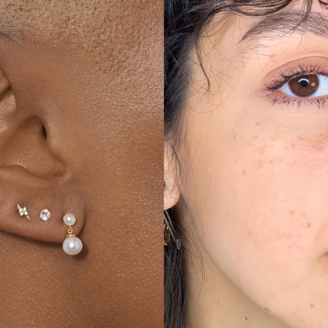 ear surface piercing