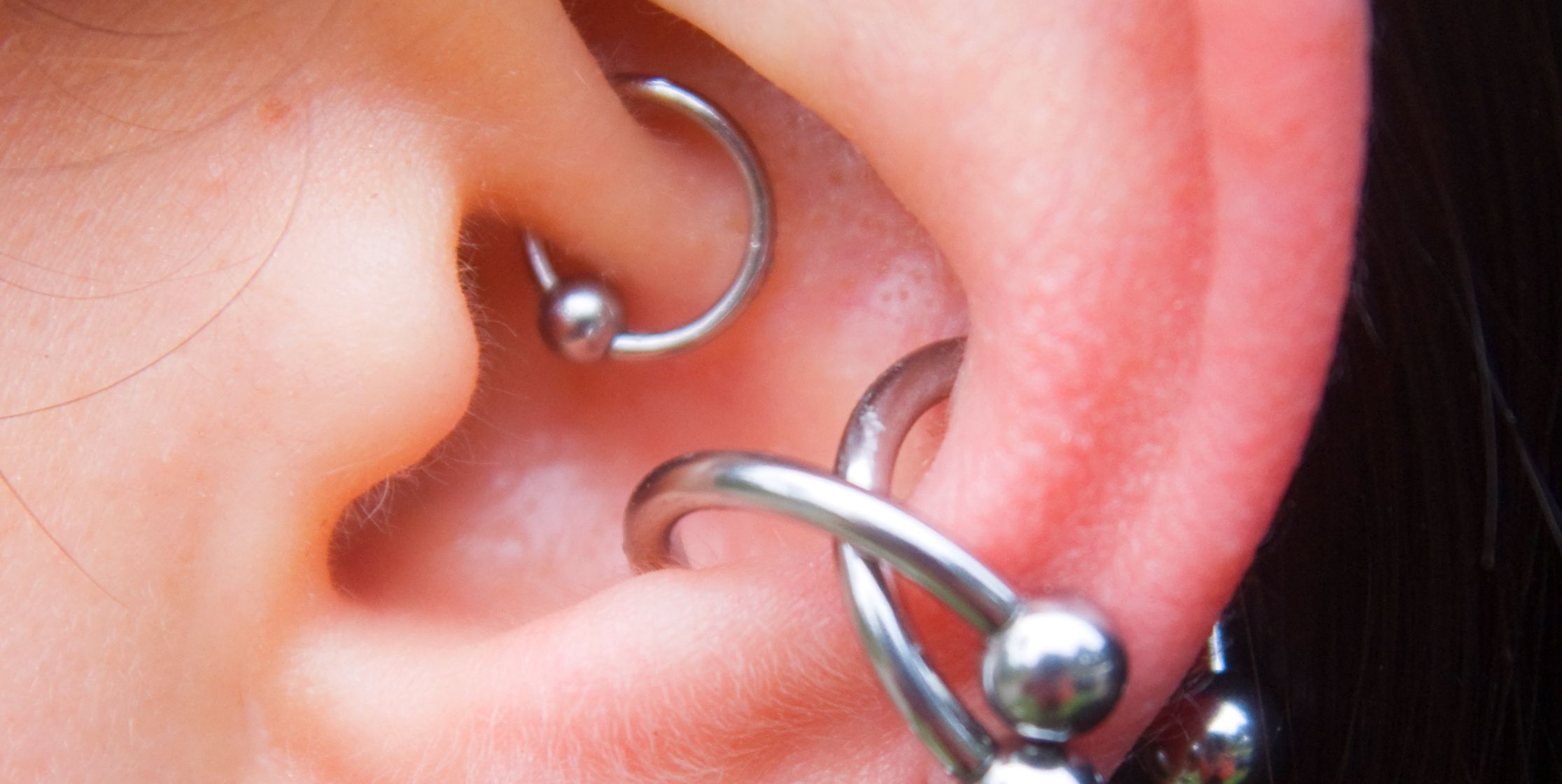 Are Daith Piercings A Legit Migraine Treatment? MDs Weigh In