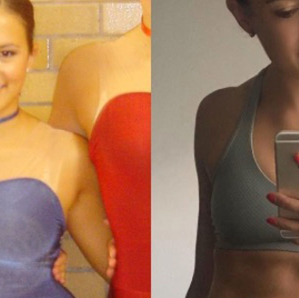 Disturbing Anti-Anorexia Ads Compare Starving Women to Fashion