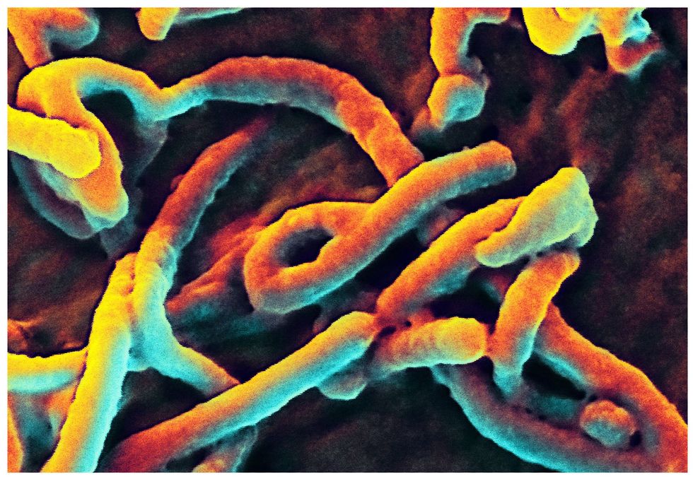 Een ingekleurde opname van een elektronenmicroscoop toont de herkenbare sliertvorm van het ebolavirus dat zich hier vermeerdert in de niercel van een kleine aap