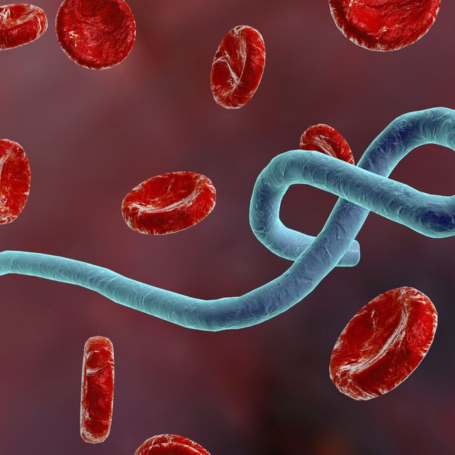 ebola outbreak 2018