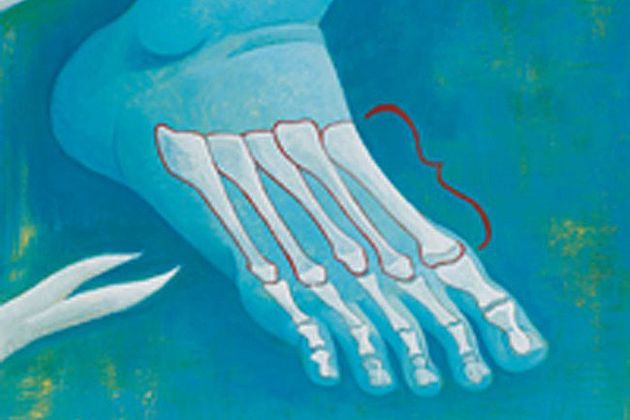 disegno delle ossa delle dita di un piede