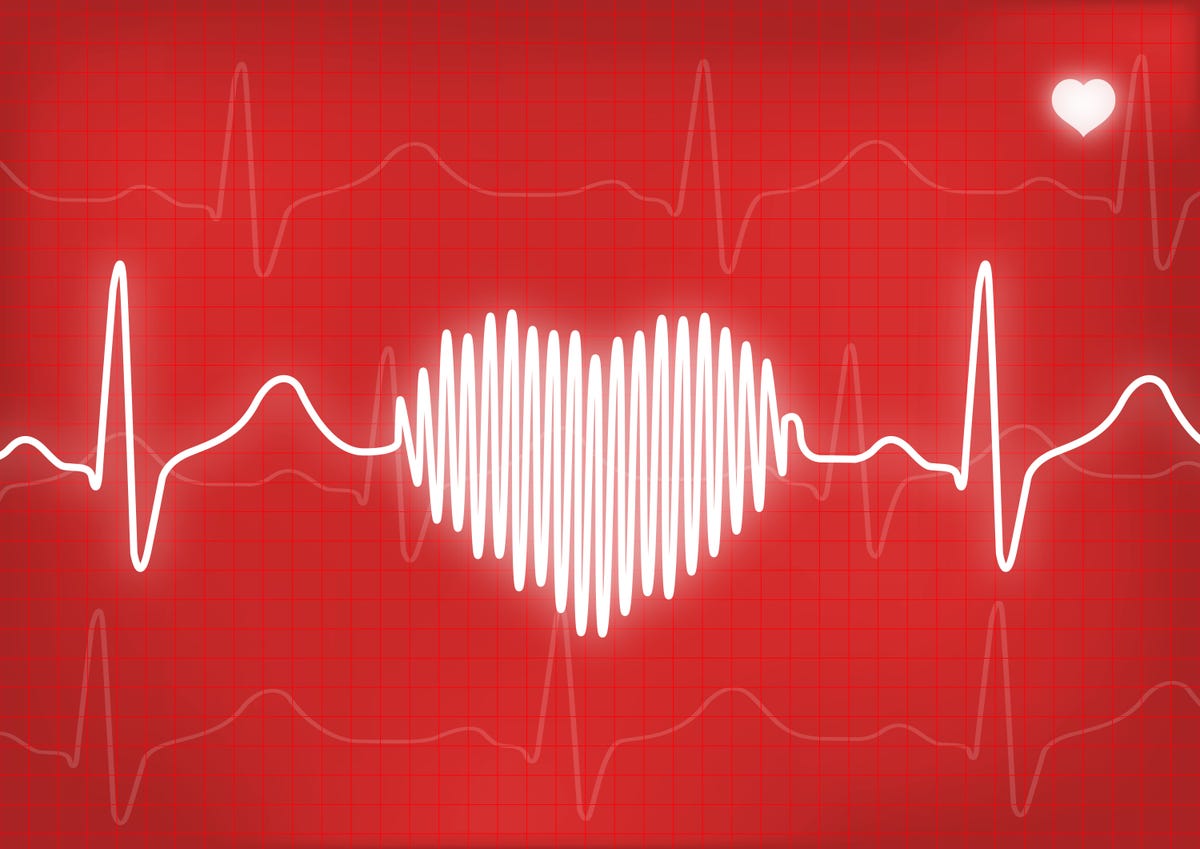 EKG