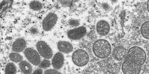 how does monkeypox virus spread