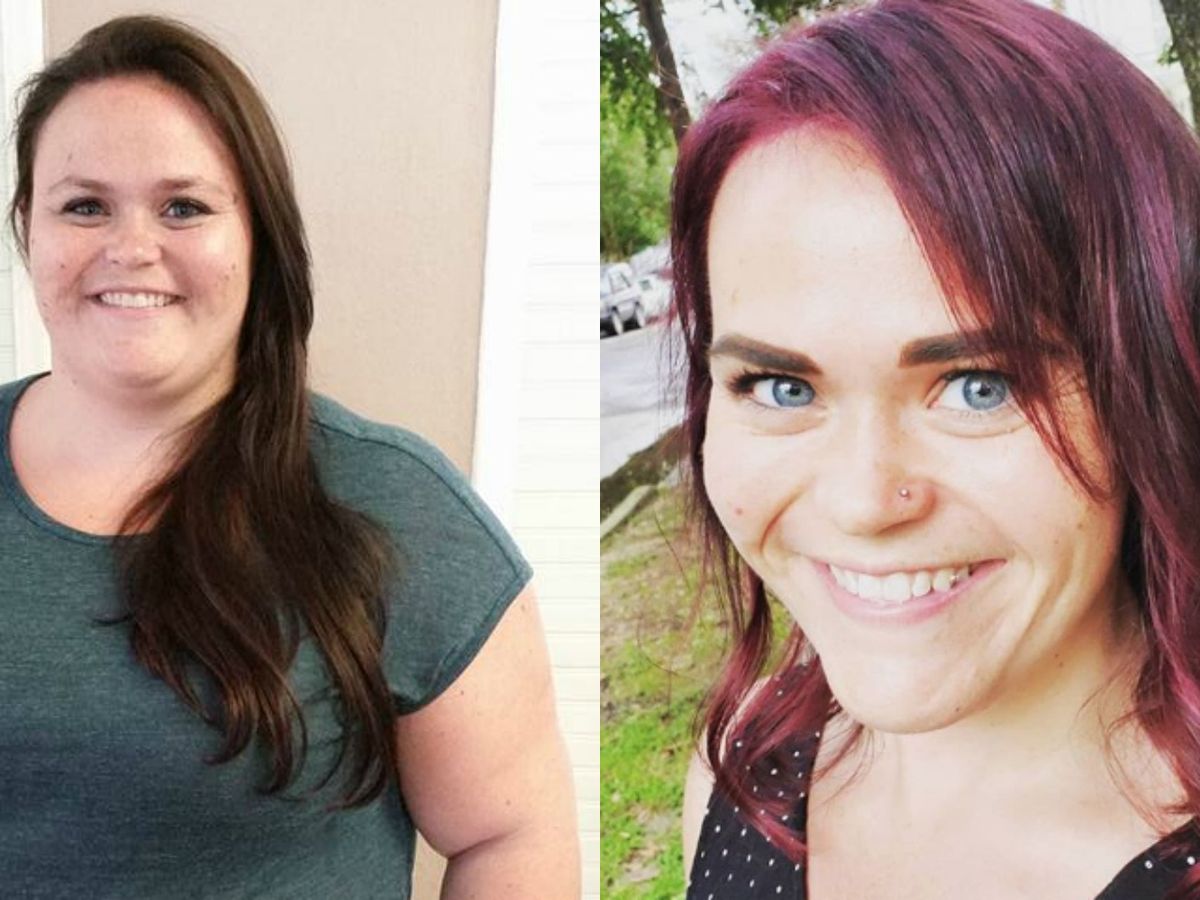 I Had Gastric Sleeve Surgery to Lose 150 Pounds - Weight Loss