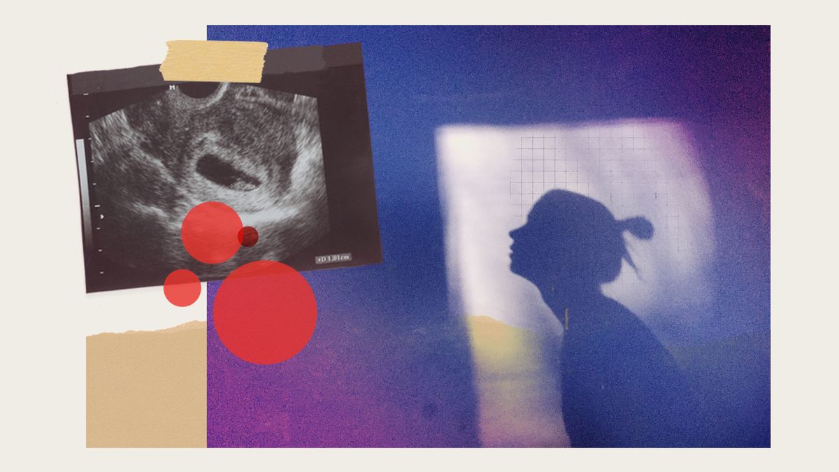 a collage featuring the silhouette of a woman, an ultrasound, and a few red circles
