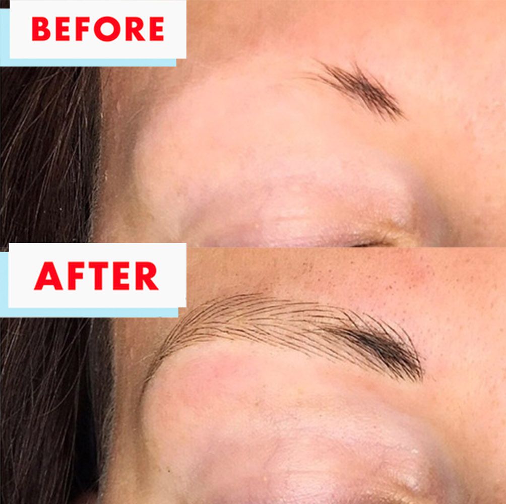 What Is Eyebrow Microblading How To