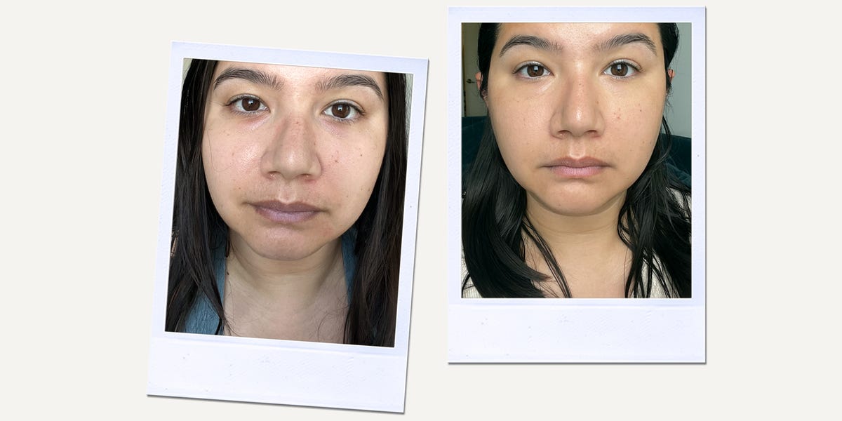 Does The Skinny Confidential Mouth Tape Really Work?