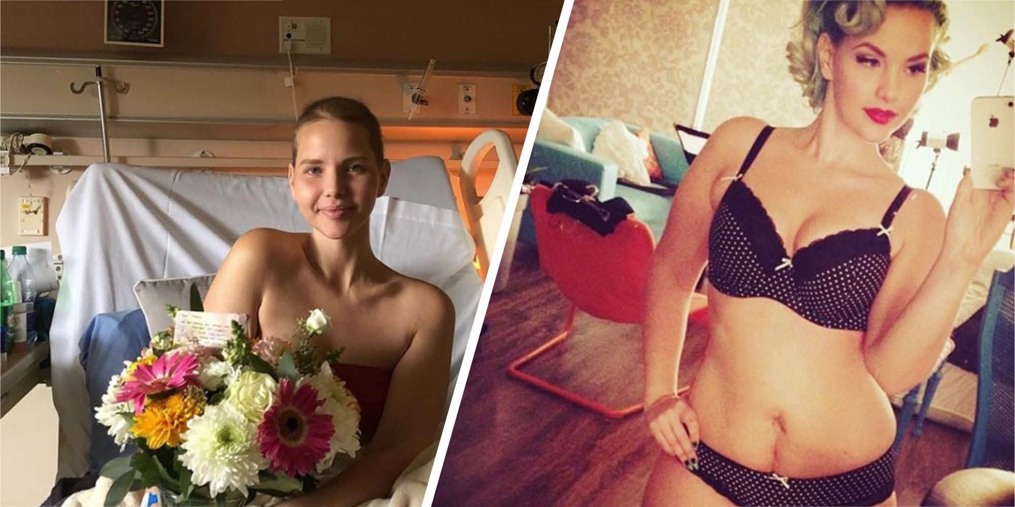 Model who proudly showed off surgery scars has died of ovarian cancer