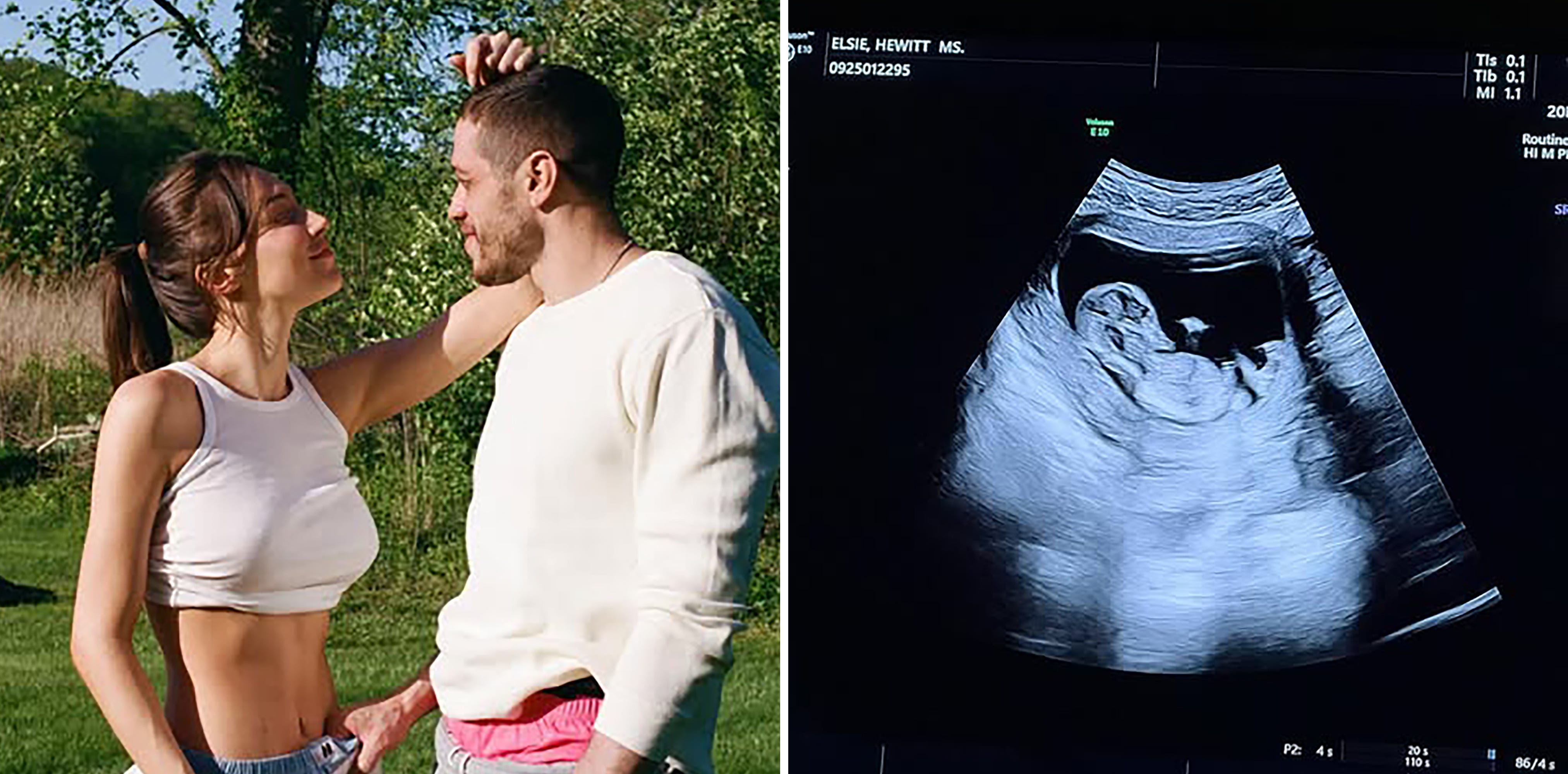 Pete Davidson expecting first child with girlfriend Elsie Hewitt after whirlwind romance