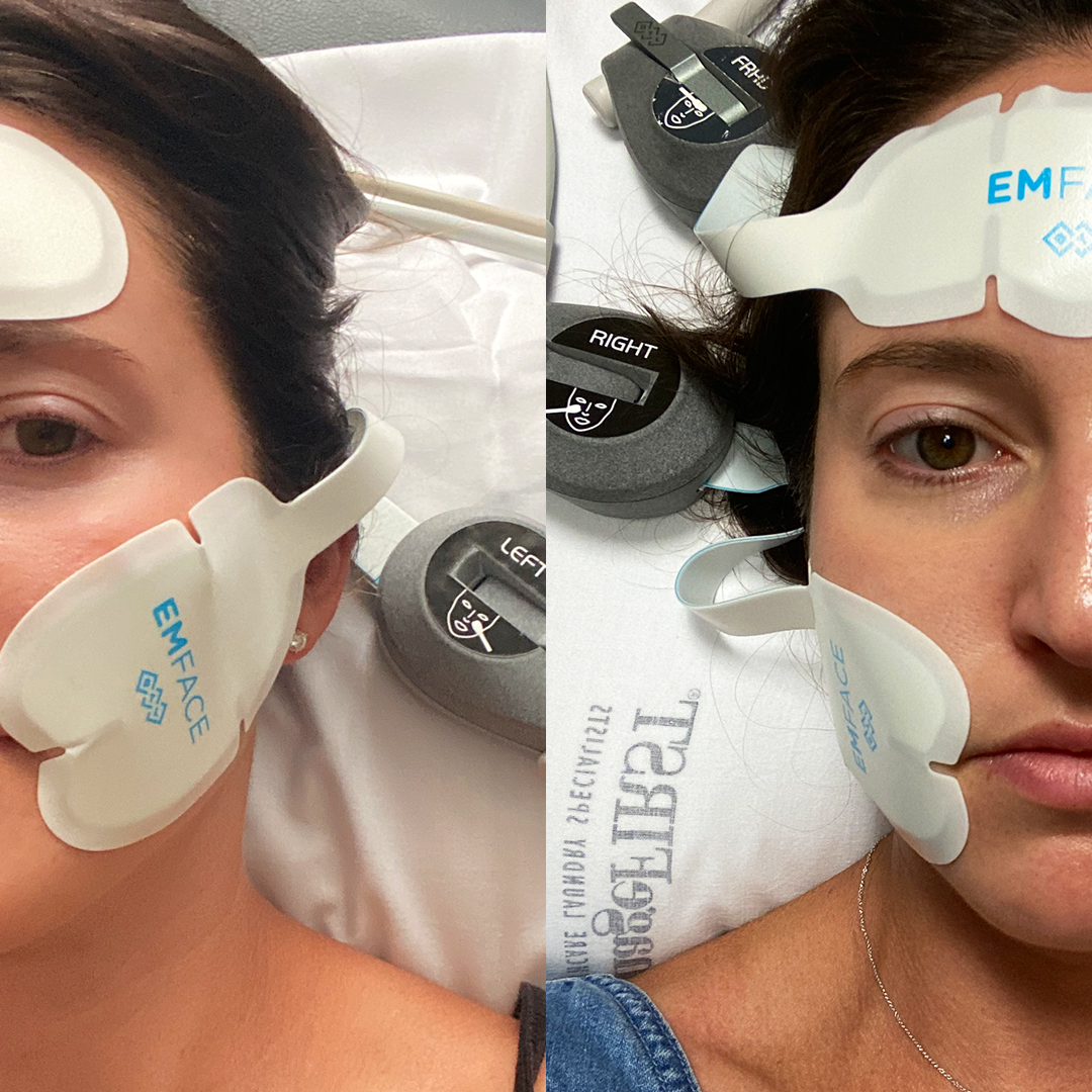 EMS (Electric Muscle Stimulation) Skincare Benefits – The CultFace