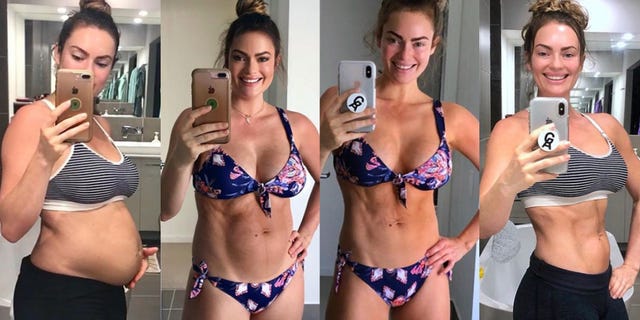 Emily Skye Shares Her Postpartum Abs Struggle (Diastasis Recti