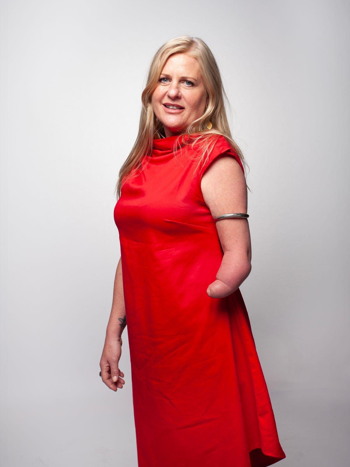 ‘With A Limb Difference, I Never Know How I’ll Do Things Until I Try Them’
