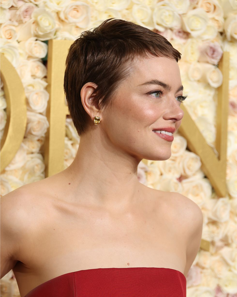 You Have To See This: Emma Stone'S Bald Head And Her Stunning Wig - 4n9804x