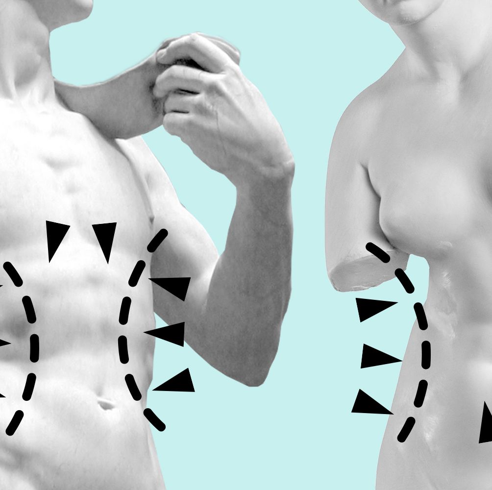 Emsculpt for Men: Six-Pack Abs By Way of Body Contouring - Cosmetic  Dermatology Center