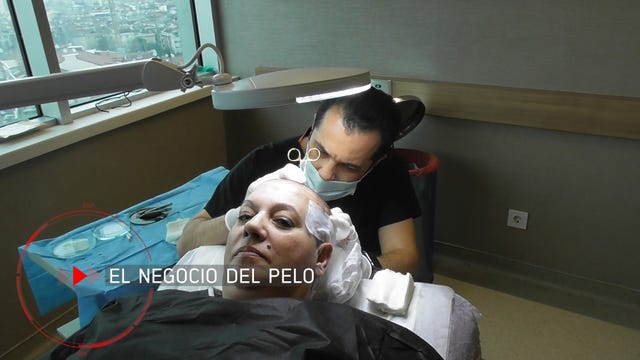 El negocio del pelo