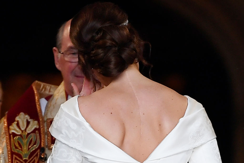 princess eugenie shows off her scar on her wedding day