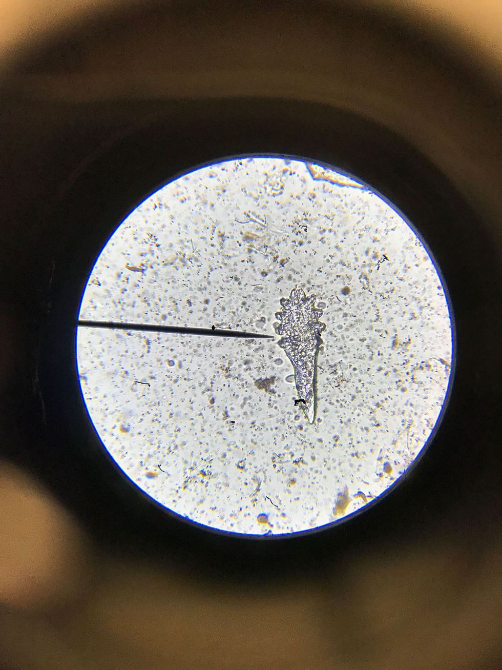 De auteur bekeek de mijten in haar eigen gezicht in het laboratorium van bioloog Rob Dunn in North Carolina Hier is er een te zien bekeken onder een microscoop een mijt van de soort Demodex brevis die leeft in de talgklieren in de porin