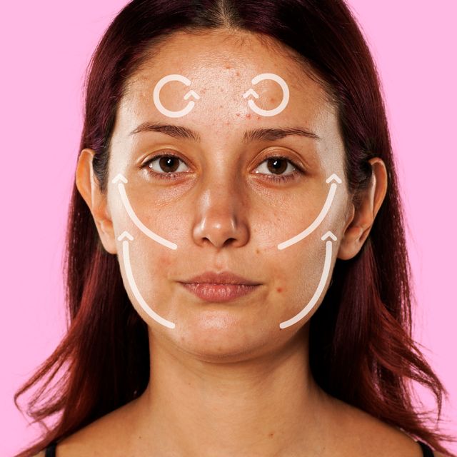 Woman with acne face massage map