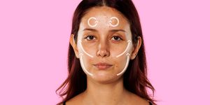 Woman with acne face massage map