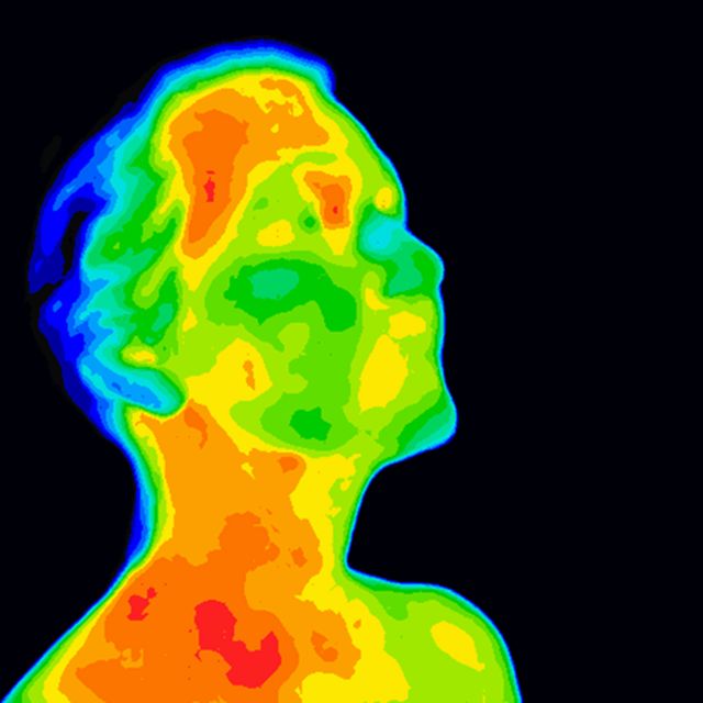 Face Thermograpy Carotid
